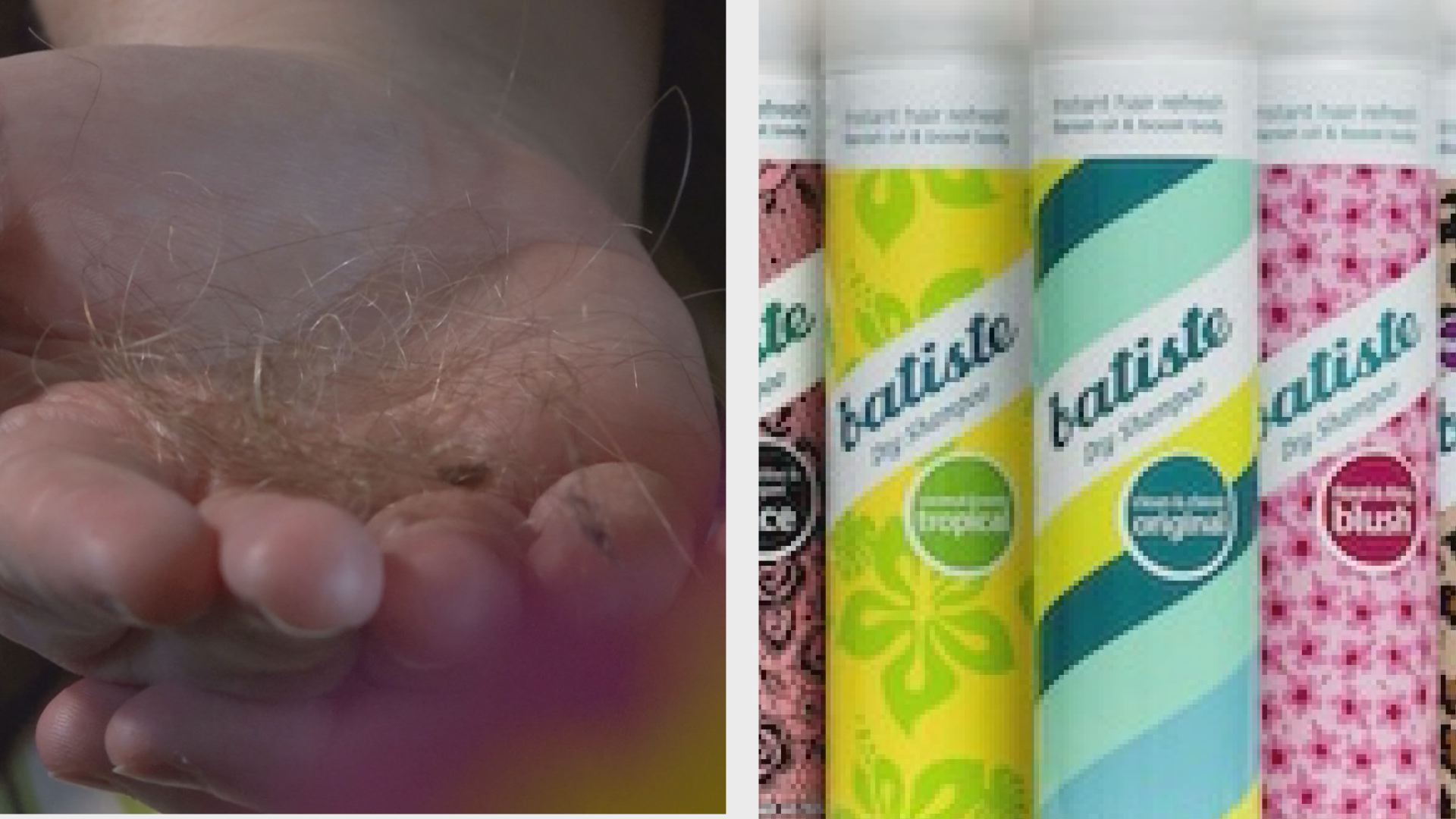 can-dry-shampoo-make-your-hair-fall-out-krem